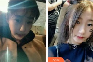 吉林中妍整形美容醫(yī)院馬速里整形價格表附光子嫩膚案例展示