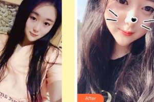 長春華璦美容醫(yī)院黃慶吉整形價格表附美白劑美白牙齒案例展示