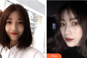 長春華璦美容醫(yī)院劉兵整形價格表附眼部綜合案例展示