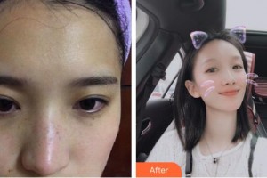 四平王清純醫(yī)療美容診所孫益民整形價格表附激光祛斑案例展示