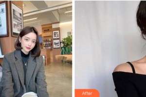 義烏華之美整形美容醫(yī)院吳曉巖整形價格表附皮膚美容案例展示