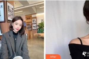 咸陽華爾醫(yī)療美容門診部王虹力整形價(jià)格表附皮膚美容案例展示