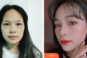 烏魯木齊新奇特醫(yī)療美容診所姜吉元整形價(jià)格表附皮膚美容案例展示