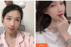 松原富華整形美容醫(yī)院夏清海整形價格表附鼻部綜合案例展示