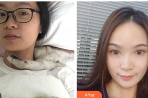 白城春俏美容整形醫(yī)院田宇整形價格表附熱瑪吉案例展示