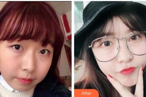 陜西省第二人民醫(yī)院眼科劉永平整形價格表附眼部綜合案例展示