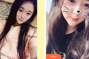 寶雞市口腔醫(yī)院丁群整形價格表附美白劑美白牙齒案例展示