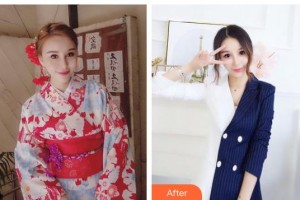 常熟金山整形美容門診部陳昌弛整形價格表附紅藍光祛痘案例展示