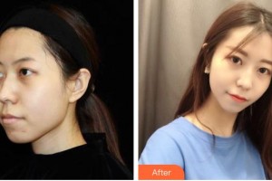 常熟金山整形美容門診部萬衛(wèi)東整形價格表附光子嫩膚案例展示