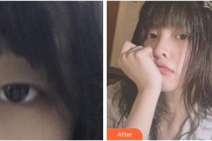 常熟瑞麗美貝爾美容醫(yī)院王大明整形價格表附眼部綜合案例展示