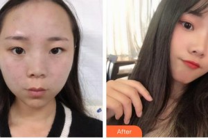 遵義韓美整形美容醫(yī)院聶波整形價(jià)格表附激光祛斑案例展示