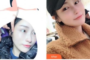 遵義韓美整形美容醫(yī)院彭全明整形價格表附激光美膚激光案例展示