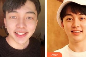 黔西南牙管家口腔醫(yī)院徐泓整形價(jià)格表附美白貼片案例展示