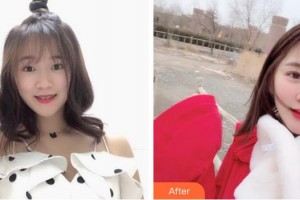 畢節(jié)西南皮膚病醫(yī)院陳超整形價(jià)格表附切開雙眼皮案例展示