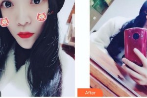 張家港萬春醫(yī)院整形美容中心羅安麗主診醫(yī)師整形價格表附微針水光案例展示