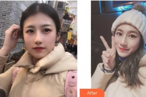 武警廣西總隊醫(yī)院醫(yī)學整形美容中心夏天整形價格表附美白導入案例展示