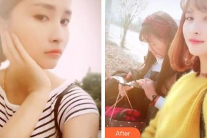 廣西愛思特整形外科醫(yī)院楊其峰整形價格表附美白貼片案例展示