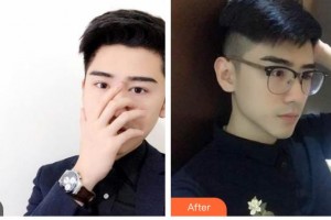 武警廣西總隊醫(yī)院醫(yī)學(xué)整形美容中心向宏偉整形價格表附鼻部綜合案例展示