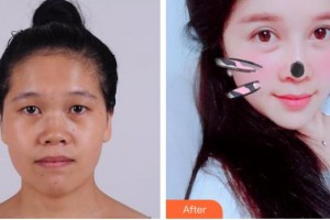 梧州市人民醫(yī)院燒傷整形科黃振強整形價格表附眼部綜合案例展示