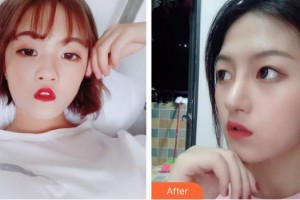 北海美秀中禾醫(yī)療美容診所謝詩涓整形價(jià)格表附眼部綜合案例展示