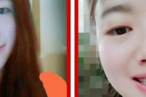 江陰牙博士口腔門(mén)診部鄭永超整形價(jià)格表附牙齒隱形矯正案例展示