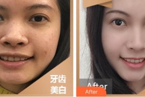 江陰牙博士口腔門診部劉曉瑋整形價(jià)格表附冷光美白案例展示