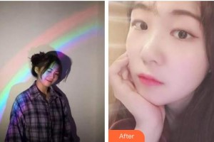 ?？诤佳谰S信口腔門診部曾婷整形價格表附超聲波潔牙案例展示