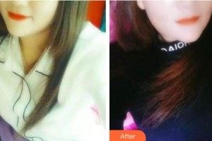 ?？隈R華祥口腔門診部馬華祥整形價格表附牙齒隱形矯正案例展示