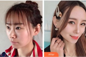 海口紅妝尚醫(yī)療美容門診部吳健整形價格表附眼部綜合案例展示