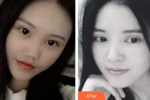 ?？诩t妝尚醫(yī)療美容門診部趙麗萍整形價格表附眼部綜合案例展示