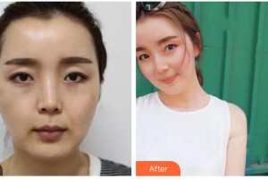 ?？诩t妝尚醫(yī)療美容門診部郭理霖整形價格表附熱拉提案例展示