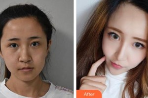 揚(yáng)州施爾美醫(yī)療美容醫(yī)院楊蘇整形價(jià)格表附激光祛斑案例展示