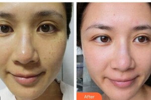 揚(yáng)州麗致醫(yī)療美容門診部翟躍中整形價(jià)格表附祛妊娠紋案例展示