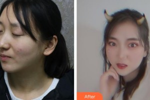 荊州市婦幼保健院眼科駱順發(fā)整形價格表附激光去眼袋案例展示