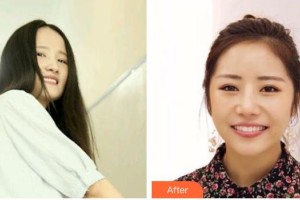 荊州公安縣楚星口腔門診徐貴方整形價格表附牙齒隱形矯正案例展示