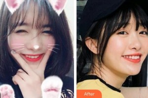 荊州公安縣楚星口腔門診黎燕整形價格表附冷光美白案例展示