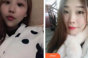 荊州沙市區(qū)楚星口腔門診部黃毅整形價格表附自鎖托槽矯正案例展示