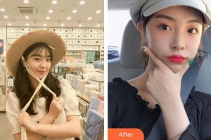 孝感仁愛醫(yī)院美容整形中心蔡光浩整形價格表附熱拉提案例展示