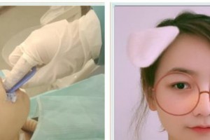 孝感君雅口腔門診高俊元整形價格表附金屬托槽矯正案例展示