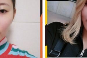 鄂州愛爾眼科醫(yī)院林思勇整形價(jià)格表附眼部綜合案例展示