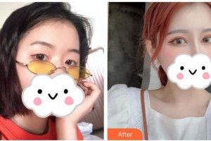 武漢佰視達(dá)眼科門診部林曉冬整形價(jià)格表附眼部綜合案例展示