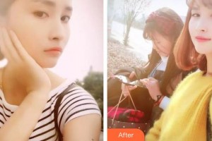 黃石中山口腔醫(yī)院郭計明整形價格表附美白劑美白牙齒案例展示