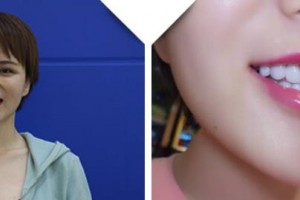 黃石現(xiàn)代口腔醫(yī)院趙險蓉整形價格表附牙貼面案例展示