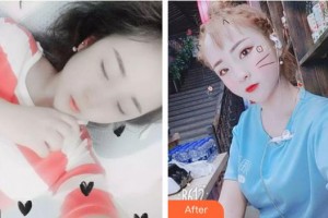 十堰愛爾眼科醫(yī)院翟坤顏整形價格表附眼部綜合案例展示