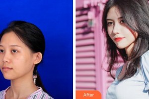 襄陽維多利亞醫(yī)療美容醫(yī)院安邰晥整形價(jià)格表附鼻部綜合案例展示