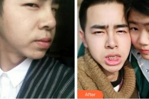 襄陽牙美口腔門診部黃盛興整形價格表附冷光美白案例展示