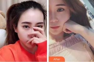 襄陽佳潔口腔醫(yī)院張利平整形價格表附牙齒隱形矯正案例展示