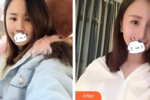 九江風(fēng)華醫(yī)療美容門診部李風(fēng)華整形價(jià)格表附膨體隆鼻案例展示