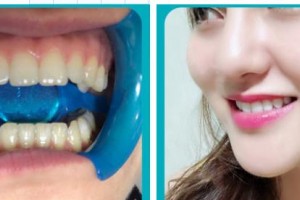 九江奇洋口腔門診部殷強(qiáng)整形價(jià)格表附美容冠案例展示