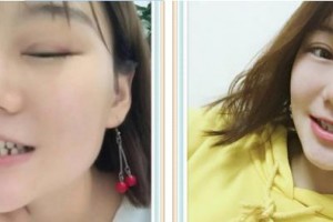 九江奇洋口腔門診部鄢智整形價(jià)格表附牙齒隱形矯正案例展示